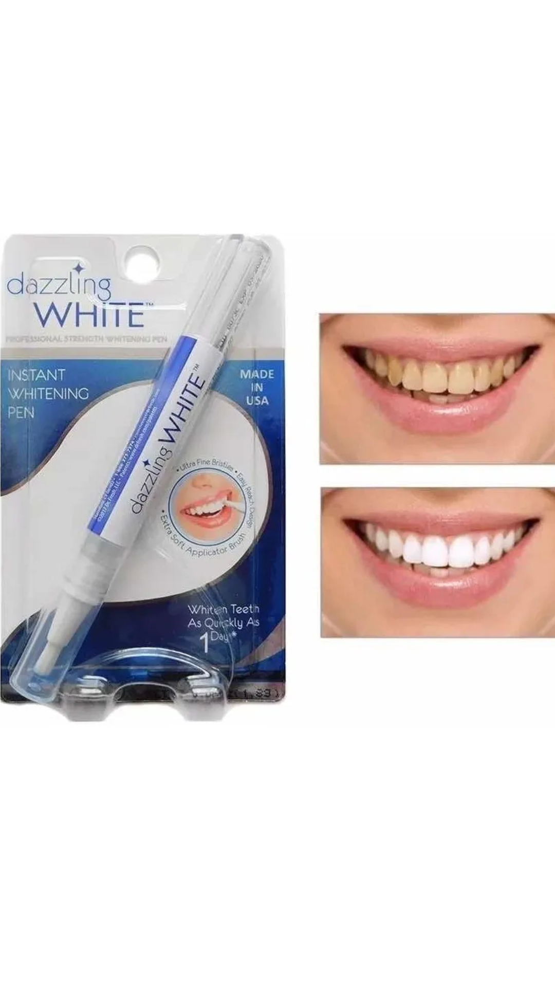 ⚡LAPIZ Blanqueador de Dientes